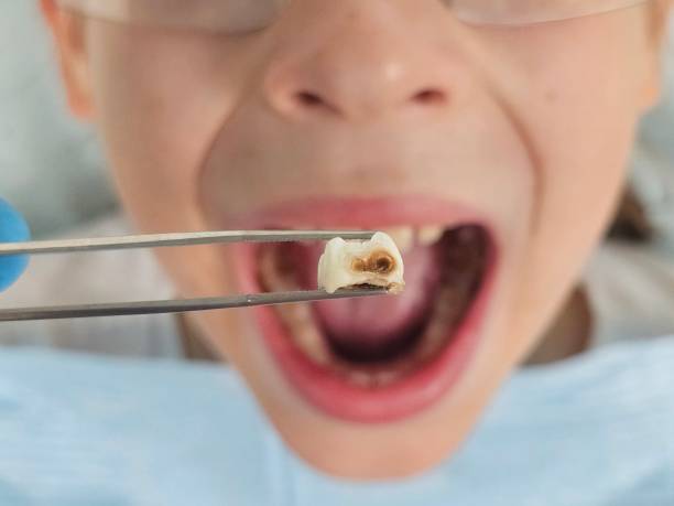 Best Emergency Treatment for Jaw Pain or Injury in Rio, WI